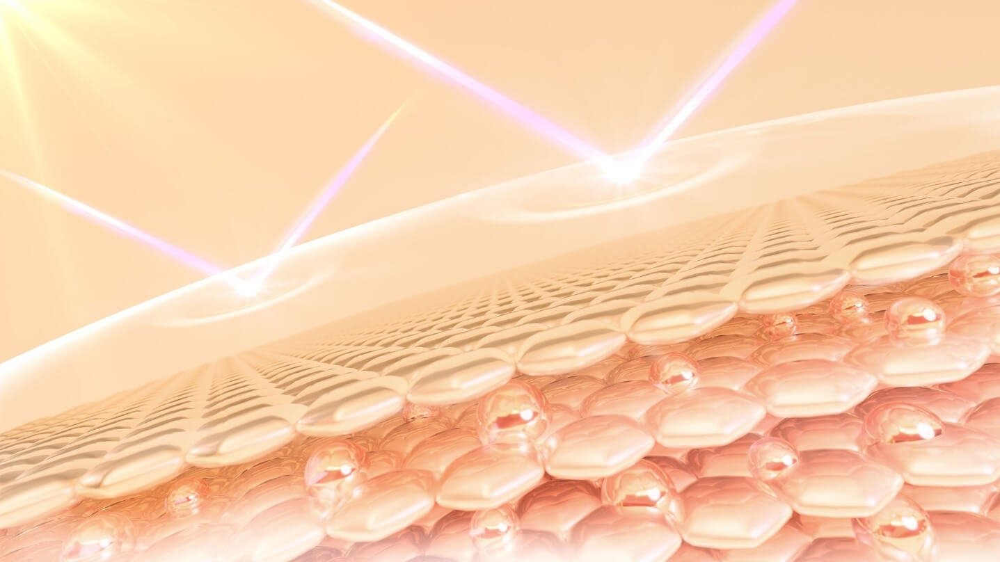 защита лъчи